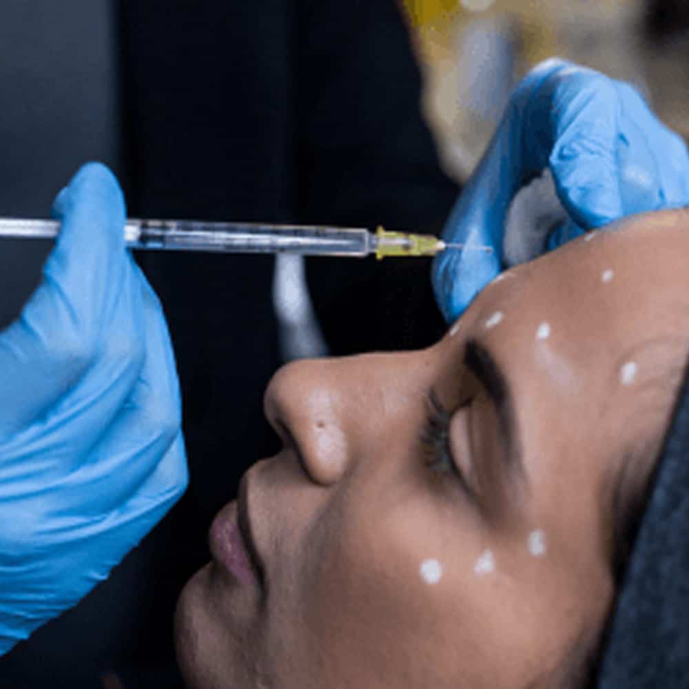 Injector holding a syringe above a patient's face marked with injection points