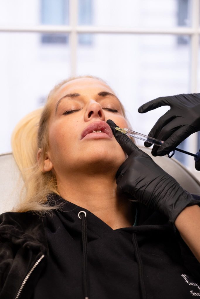 A practitioner in black gloves injects dermal filler into a patient's lip.