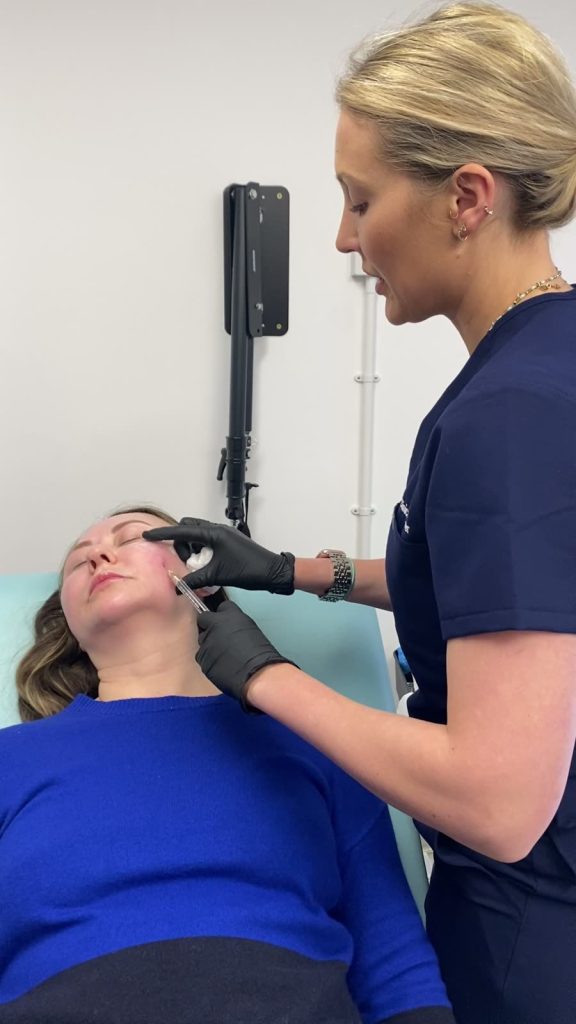 A trainer treats the under-eye area of a model patient during a Tear Trough masterclass.