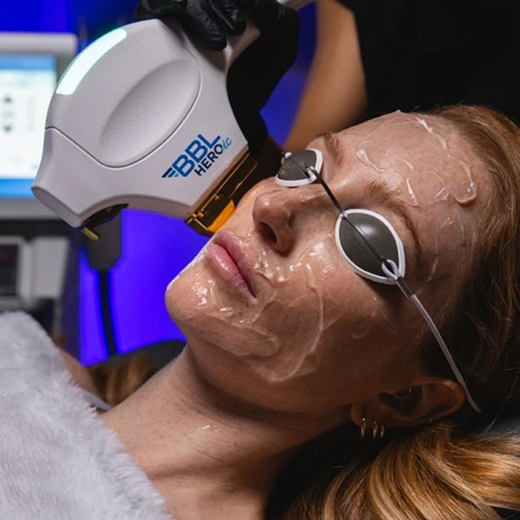 A patient receiving a precise BBL HEROic treatment from a clinician.